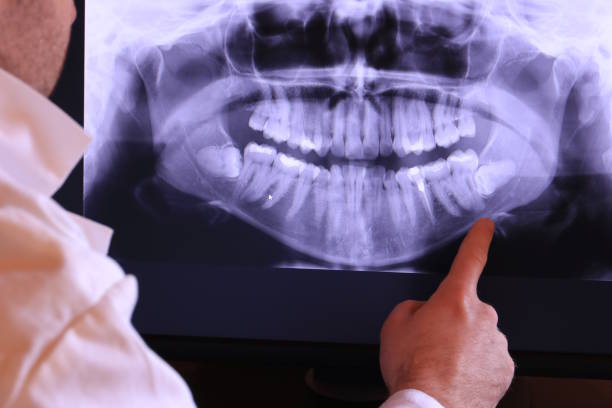 Best Emergency Treatment for Toothache in Fargo, ND